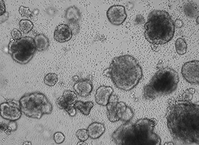 類器官成像分析